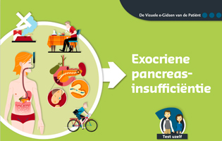 Exocriene pancreas-insufficiëntie
